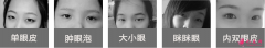 哪些眼皮需要做雙眼皮手術?