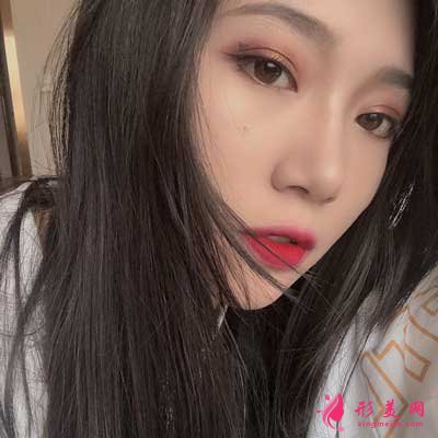 雅美整形趙世華為我做的鼻子 術(shù)后第40天效果真的很不錯(cuò)