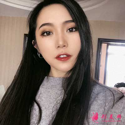 趙世華醫(yī)生為我做的鼻子 術(shù)后第20天效果恢復(fù)圖分享