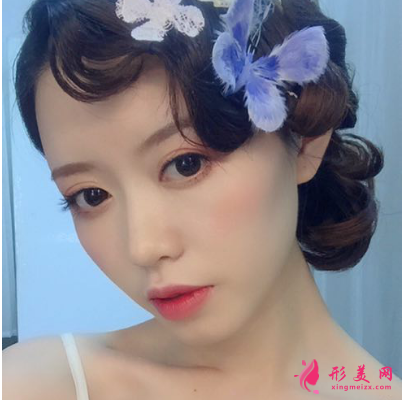 生命加醫(yī)療美容醫(yī)院做鼻子怎么樣？假體隆鼻術(shù)后90天效果真的好