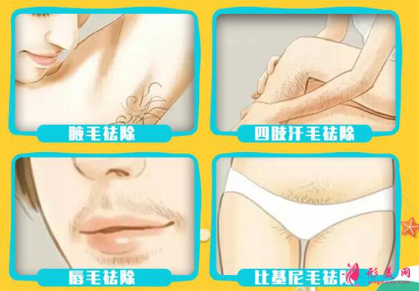 四肢脫毛手術(shù)推薦