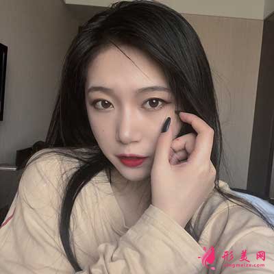 在雅美整形找趙世華做的鼻子 術(shù)后60天隆鼻真人案例分享