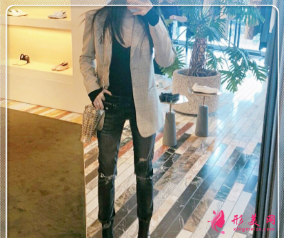 杭州維多利亞馬騰做大腿吸脂怎么樣？案例60天前后對比圖分享