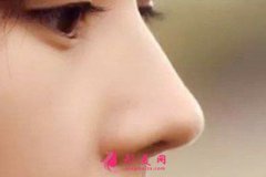 時(shí)光整型美容醫(yī)院肋軟骨隆鼻多少錢？
