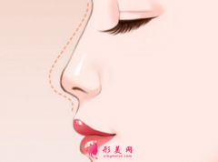 長沙美容整容，假體隆鼻手術要多少錢？