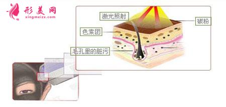 做黑臉娃娃費(fèi)用多少