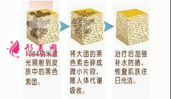 做黑臉娃娃費(fèi)用多少