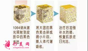 做黑臉娃娃費(fèi)用多少