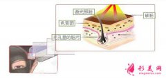 上海華美整型美容醫(yī)院做黑臉娃娃費(fèi)用是多少？會(huì)傷害皮膚嗎？？