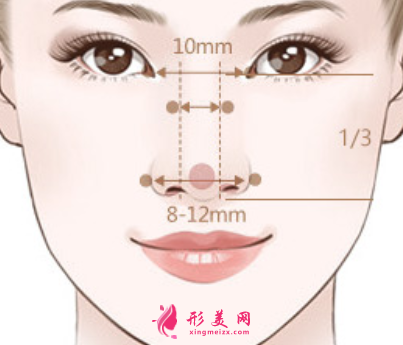 肋軟骨隆鼻后多久恢復(fù)正常