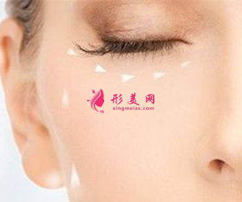 手術(shù)祛眼袋痛嗎