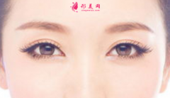 全切雙眼皮以后會變成內(nèi)雙嗎？