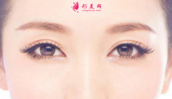 全切雙眼皮以后會(huì)變成內(nèi)雙嗎.png