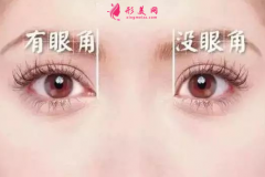 開眼角疤痕多久會(huì)消失？