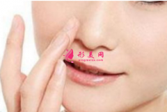 鼻翼肥厚要怎么縮小