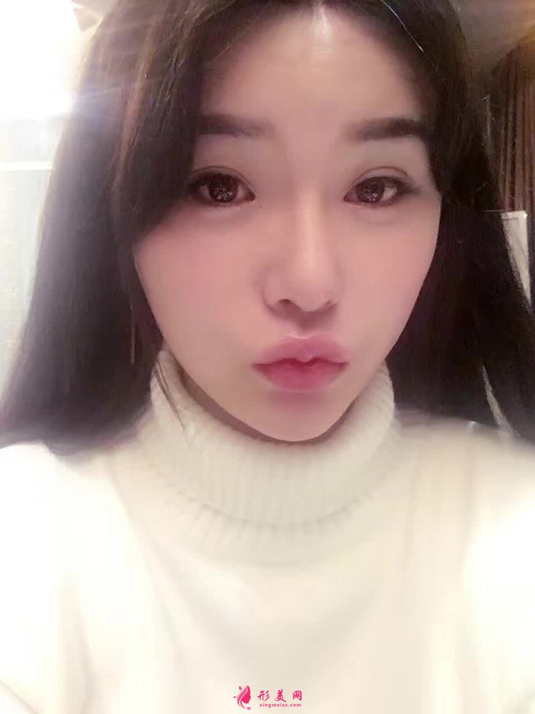深圳赫思醫(yī)療美容怎么樣？價目表及網(wǎng)紅鼻整形案例
