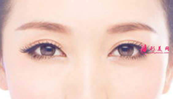 雙眼皮術(shù)后要注意的問(wèn)題.png