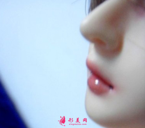 鼻整形修復(fù).png