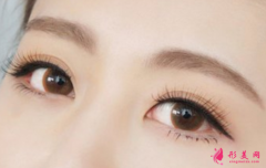 時(shí)光醫(yī)療美容割雙眼皮眼睛會(huì)變大嗎？