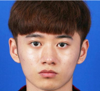 上海美萊醫(yī)學(xué)美容醫(yī)院歐陽春做鼻綜合整形好不好？附上術(shù)后感受分