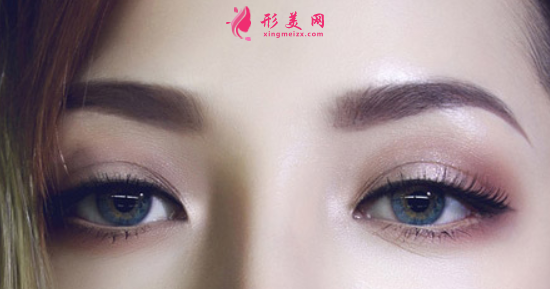 雙眼皮修復(fù)一般需要多少錢