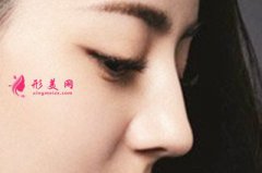 假體隆鼻術(shù)后疤痕明顯需要做修復(fù)手術(shù)嗎？