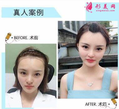 北京大學(xué)深圳整形外科口碑