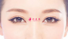 雙眼皮手術(shù)消腫注意事項有哪些