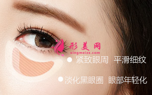 手術(shù)祛眼袋多久恢復(fù)自然