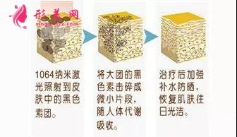 做黑臉娃娃哪里好