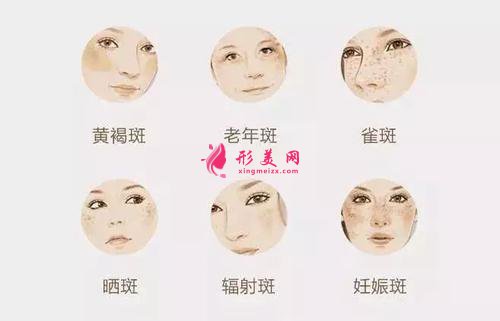 做黑臉娃娃哪里好