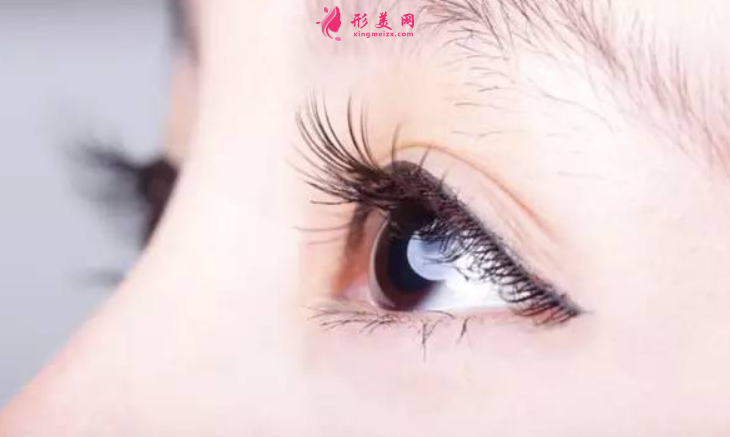 做雙眼皮手術(shù)要多長(zhǎng)時(shí)間