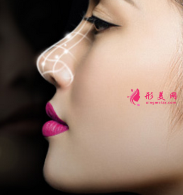 假體隆鼻價(jià)格受什么因素影響