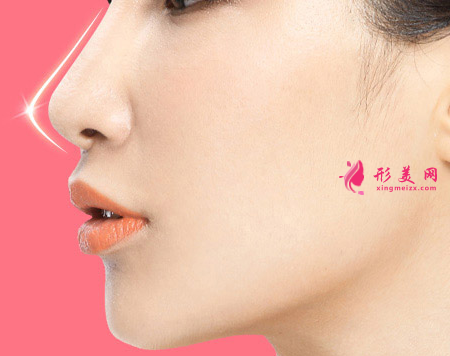 假體隆鼻價(jià)格受什么因素影響