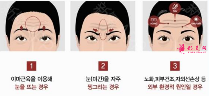 如何去除抬頭紋
