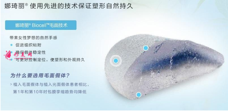 娜綺麗隆胸多少錢