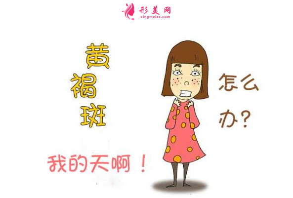 如何去黃褐斑比較有效？