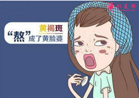如何去黃褐斑比較有效？