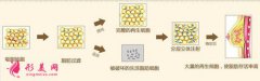 自身脂肪隆胸手術(shù)比假體好嗎？手術(shù)費(fèi)用~