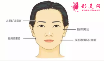 自體脂肪面部填充