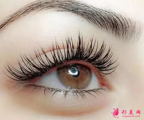 開眼角手術(shù)多少錢左右