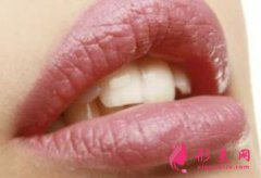 杭州唇腭裂修復(fù)價(jià)格需要多少錢？效果怎么樣？