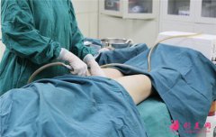 為什么說大腿吸脂不安全？艾恩整形金承俊告訴你真相！
