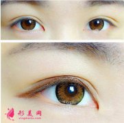 長沙伊百麗雙眼皮修復效果好嗎？