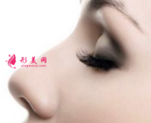 上海隆鼻大約要多少錢？