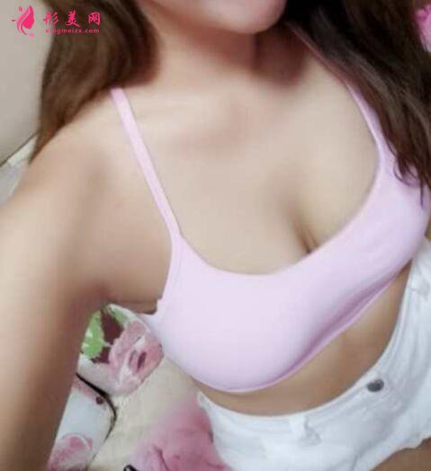 手術(shù)局麻比較好