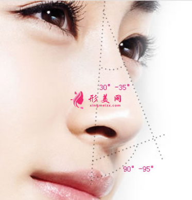 假體隆鼻后鼻頭發(fā)紅怎么辦