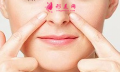 鼻翼縮小手術(shù)適合什么人群？