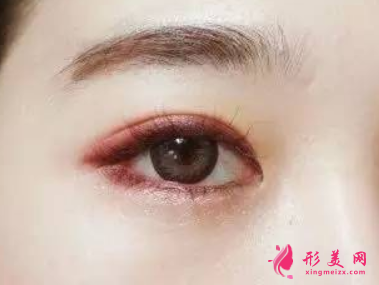 內(nèi)眼角修復(fù)會越修越難看嗎