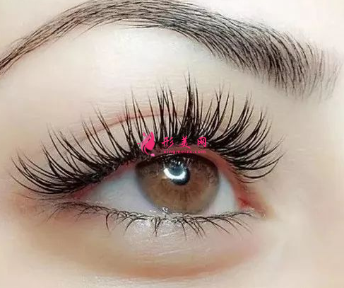 廣州開(kāi)內(nèi)眼角多少錢(qián)